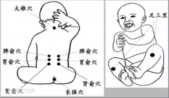 捏脊疗法