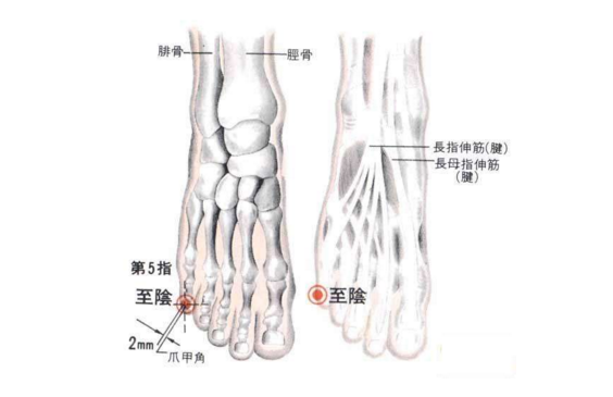 艾灸至阴穴的功效