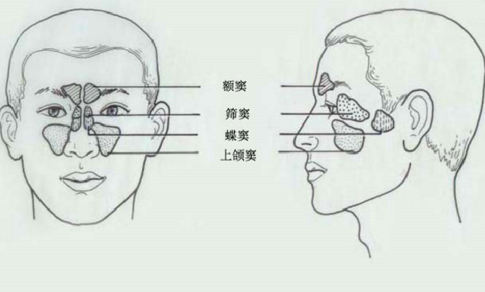 鼻窦支气管综合征的症状表现