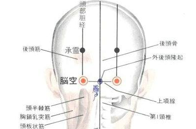 脑空穴的示意图