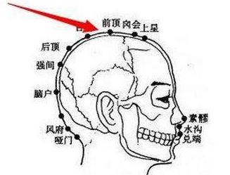 前顶穴示意图