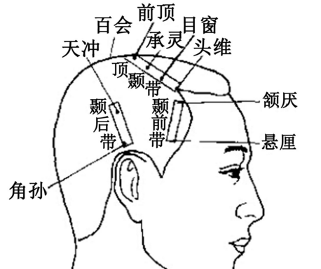 前顶穴名解