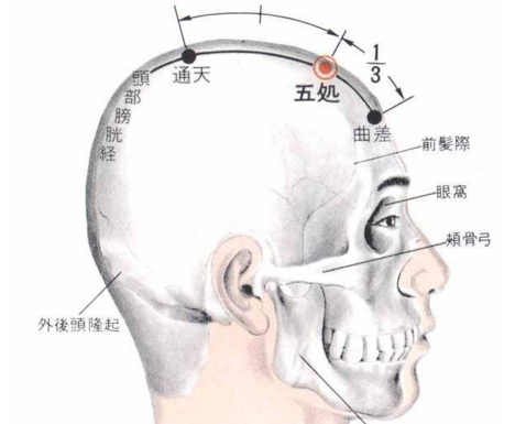 曲差穴主治疾病