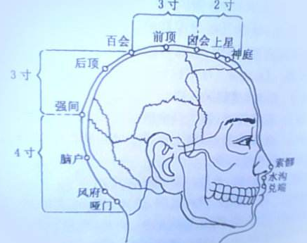 囟会穴示意图