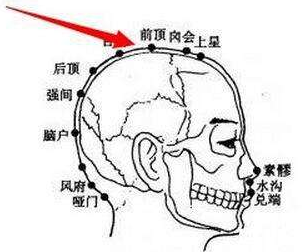 囟会穴位位置