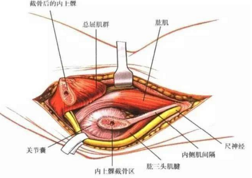 副神经损伤原因