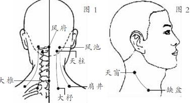 缺盆穴位位置