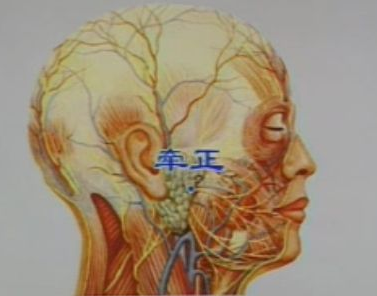 牵正穴主治病症