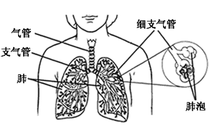 胆固醇肺炎怎么治疗