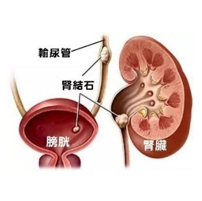 从尿液看肾脏健康，这些肾病症状你有吗？