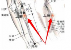 中医针刺上廉穴治疗踝关扭伤的方法及其上廉穴的准确位置！