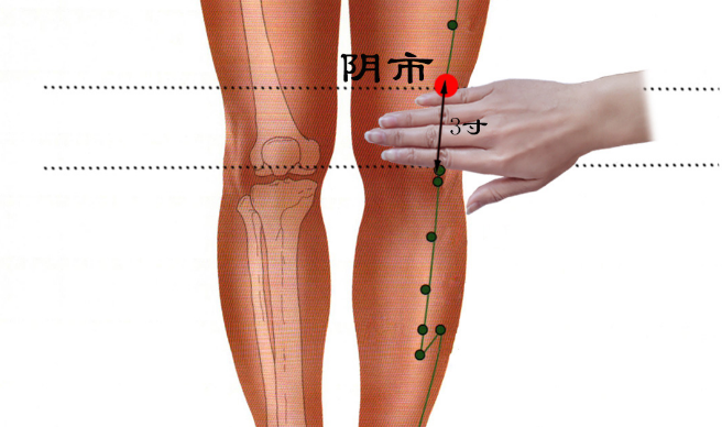 阴市穴治疗糖尿病