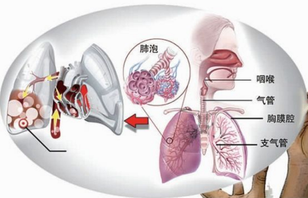 肺大疱的预防