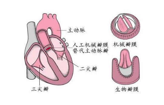 肺动脉发育不全的预防