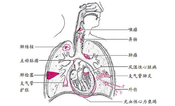 肺寄生虫病的检查