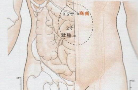 商曲穴的刺灸法