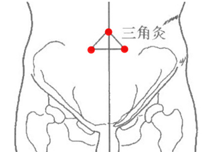 三角灸穴位位置