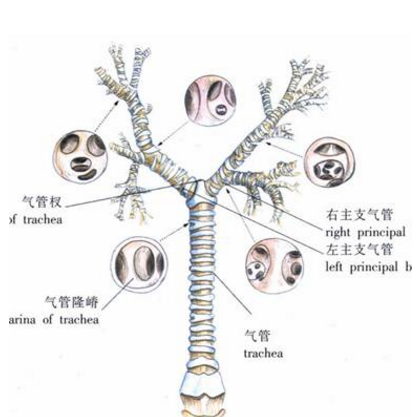 肺络张如何鉴别？它的症状表现及其治疗方法有哪些？