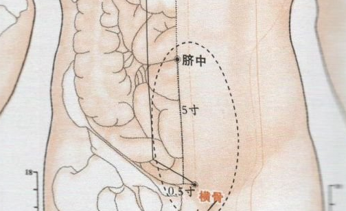 横骨穴刺灸法