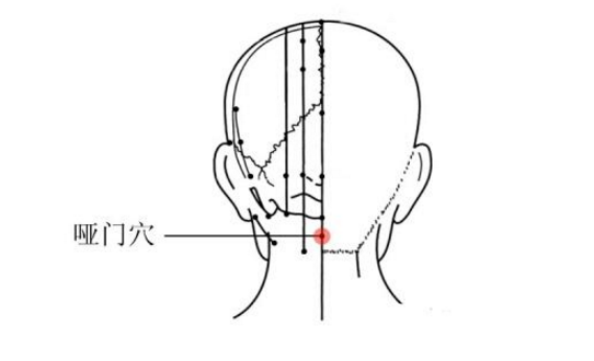 哑门穴主治疾病