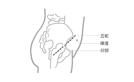 五枢穴穴位配伍